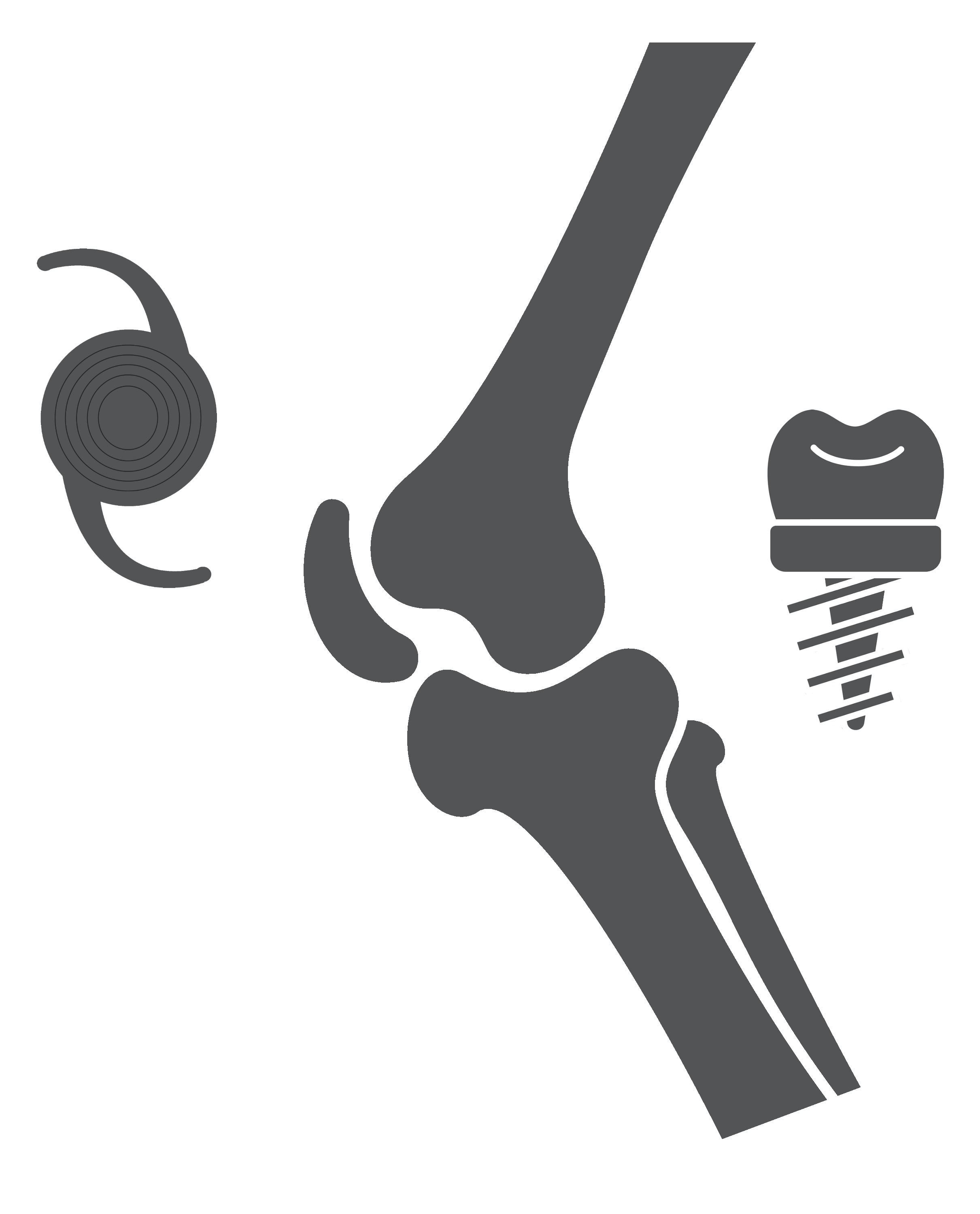 Prosthesis2-1 Prosthesis2-1
